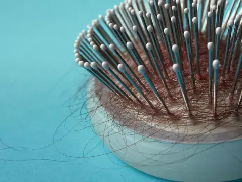 Fallen mir nach einer Chemotherapie die Haare aus?