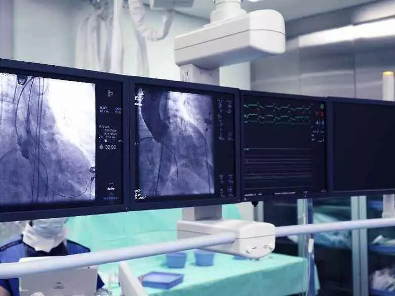 Was sind die Vorteile einer koronaren Revaskularisation?