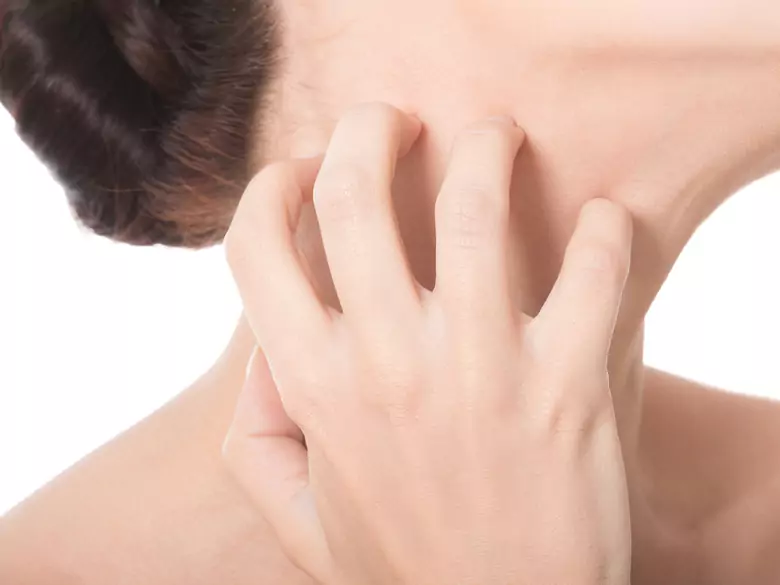 Atopische Dermatitis: Wie kann man sie behandeln?