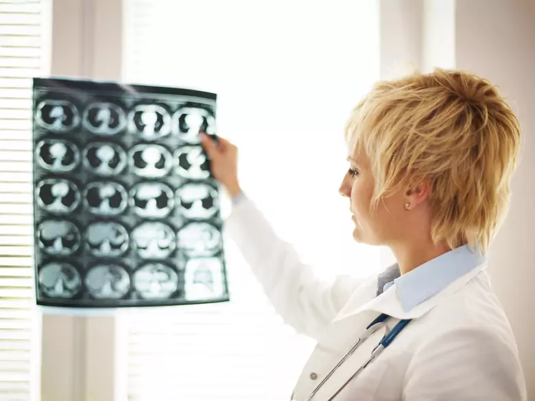 TIA - transitorische ischämische Attacken