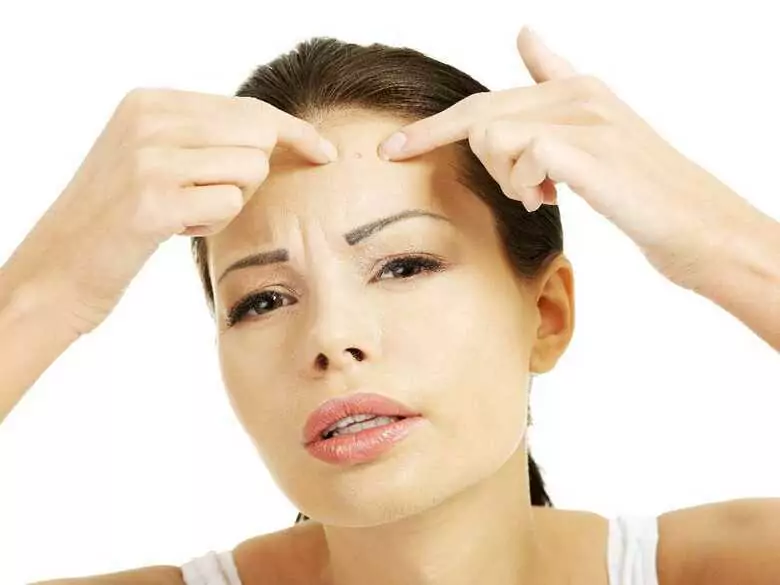 Akne nach 30: Was müssen Sie wissen?