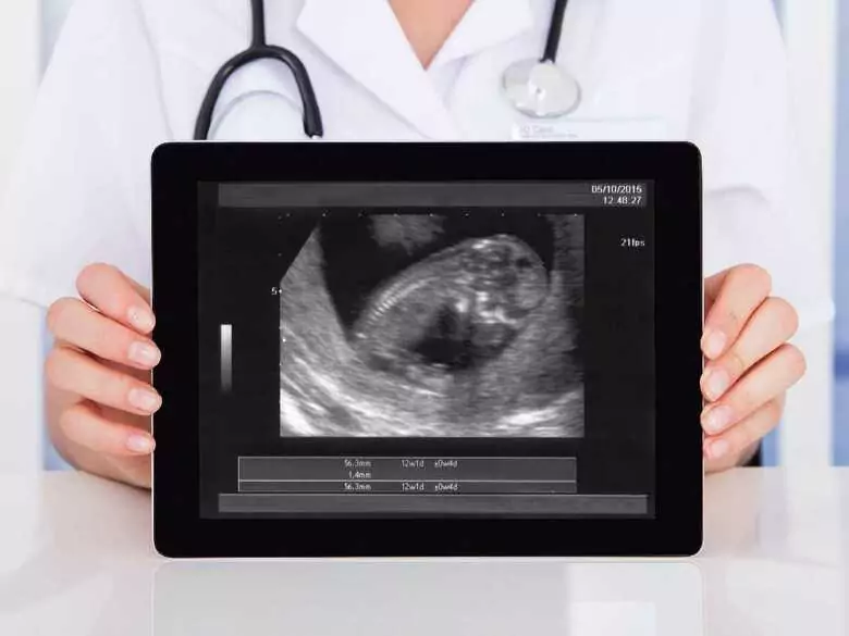 Ektopische Schwangerschaft - was ist das und was sind die Ursachen?