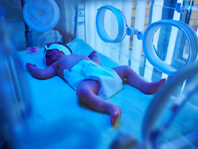 Frühgeburtlichkeit und Sterblichkeit: Finden Sie die Faktoren heraus, die das Leben Ihres Babys gefährden können