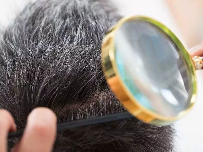 Läuse bei Kindern - wie kann man sie wirksam behandeln und verhindern?