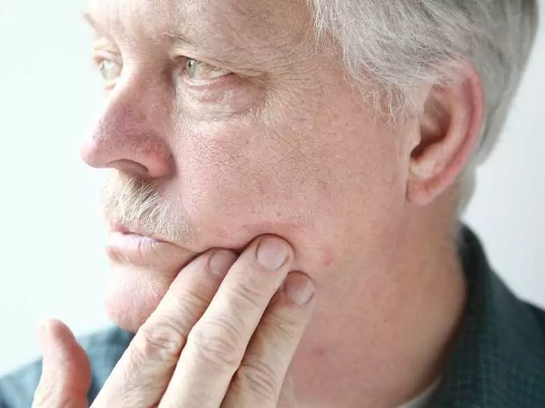 Lipome in der Mundhöhle - wie vorgehen?