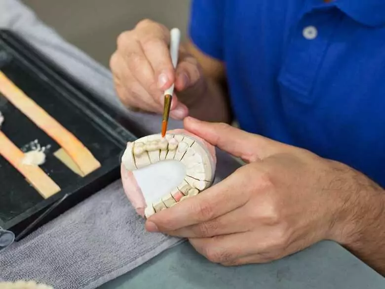 Spitze oder Veneer - was soll man wählen?