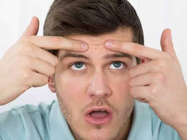 Emollients für Akne bei Erwachsenen