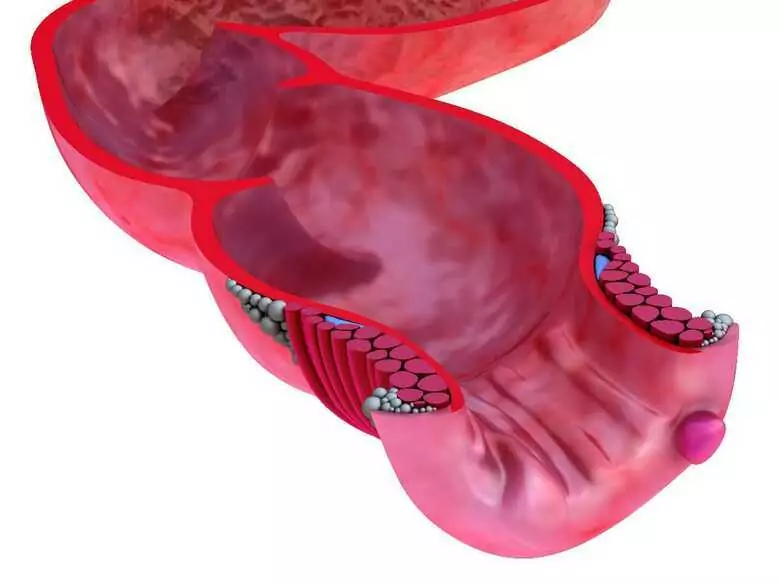 Thrombusbildung und -entwicklung - tiefe Venenthrombose