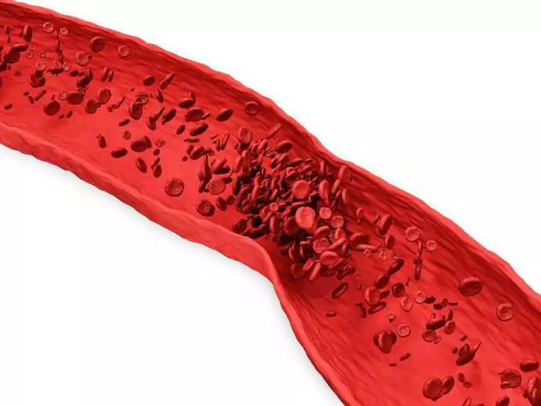 Die Schilddrüse, ihre Erkrankungen und der Cholesterinspiegel